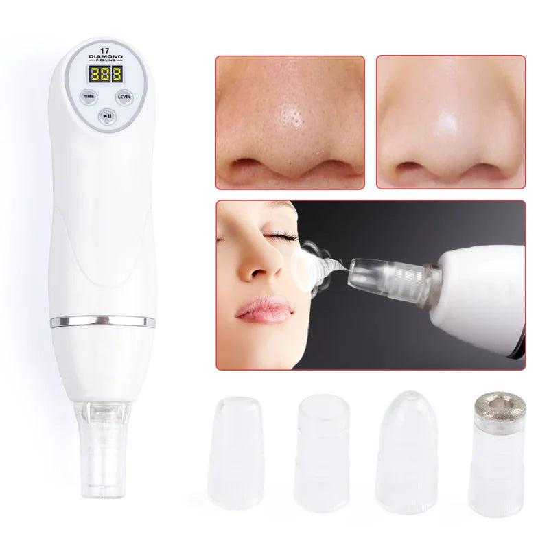 Appareil de microdermabrasion